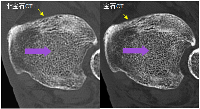 ʯCTGE߶CT