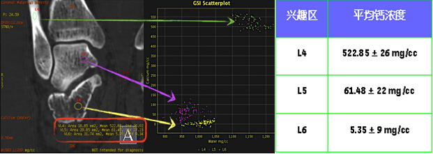 ʯCTGE߶CT