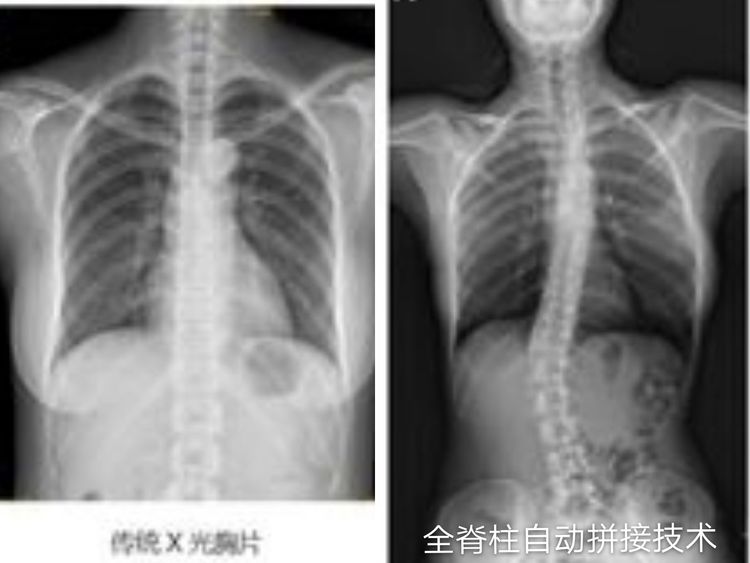 豸