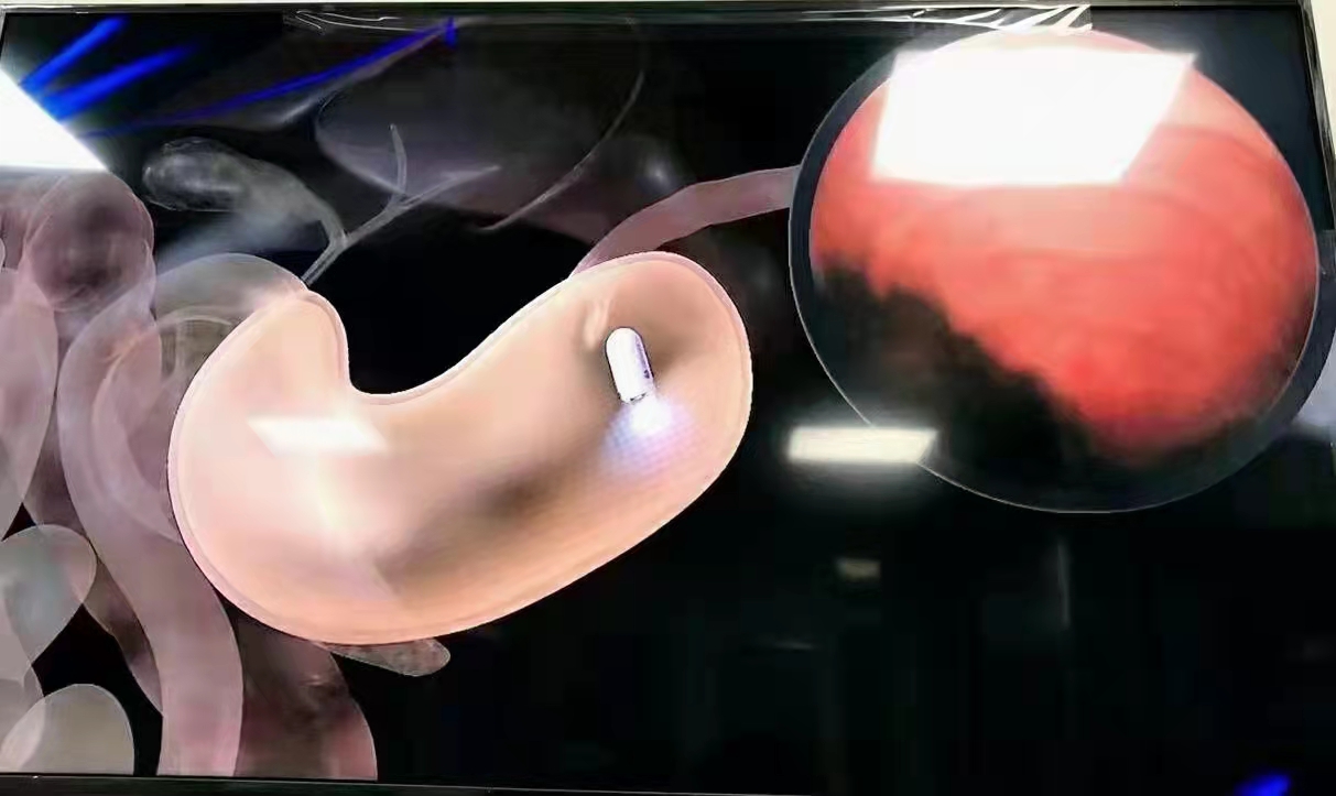 ΢ͼƬ_20220316095659.jpg