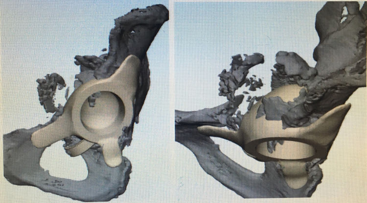 3DӡˣĳԺǿɹӦ3Dӡƹؽڽžʾ޴ȱķ